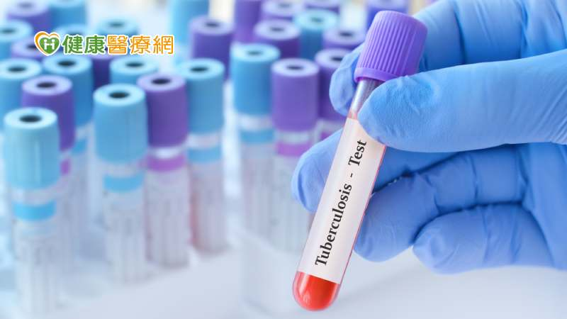 預防結核病從篩檢、治療做起! 完成LTBI檢驗、治療還有機會抽大獎