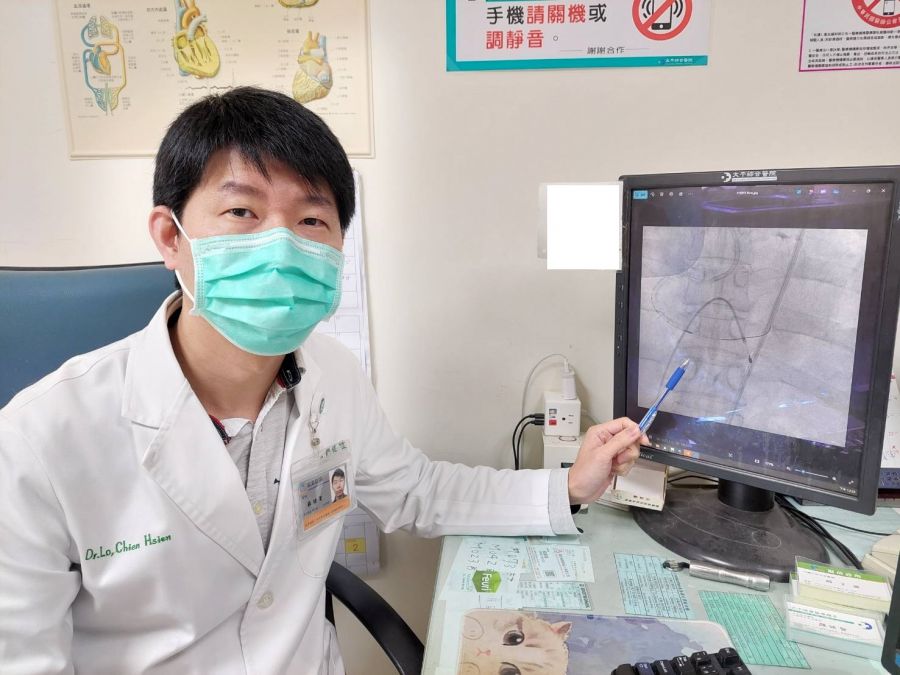 62歲婦血管嚴重鈣化狹窄 心導管冠狀動脈旋磨術成功救治