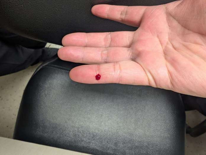扯!遭未分類廢棄針頭刺傷 機場檢疫護理師控主管刁難請假 50 486623515 17900914560115428 8590190527342634432 n