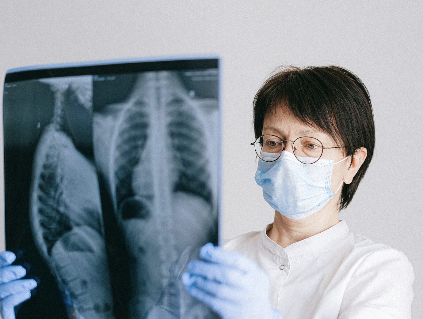 肺癌死亡率連9年下降 保命全靠一招「存活率從1成變9成」 246 肺癌死亡率連9年下降 保命全靠一招「存活率從1成變9成」 245