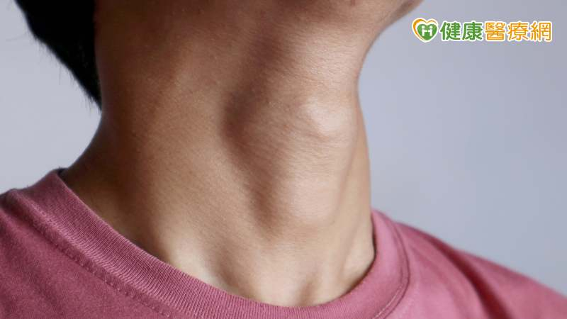 女生也會有喉結?擔心是健康出問題?醫列伴隨「4症狀」要就醫檢查!