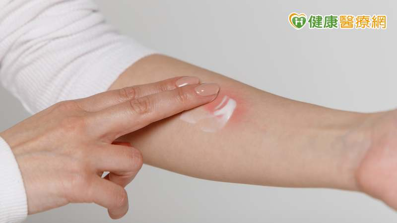 換季皮膚癢 外用藥擦越多越好?醫破解「3迷思」籲正確用藥