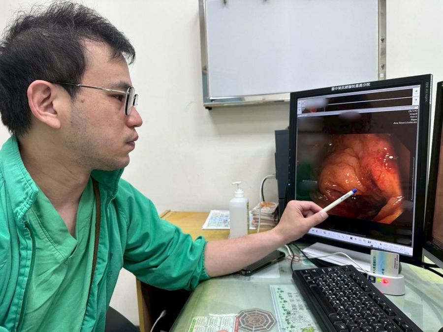 大腸息肉及早切除治療  嘉榮呼籲定期做健康檢查 助你「腸」保安康
