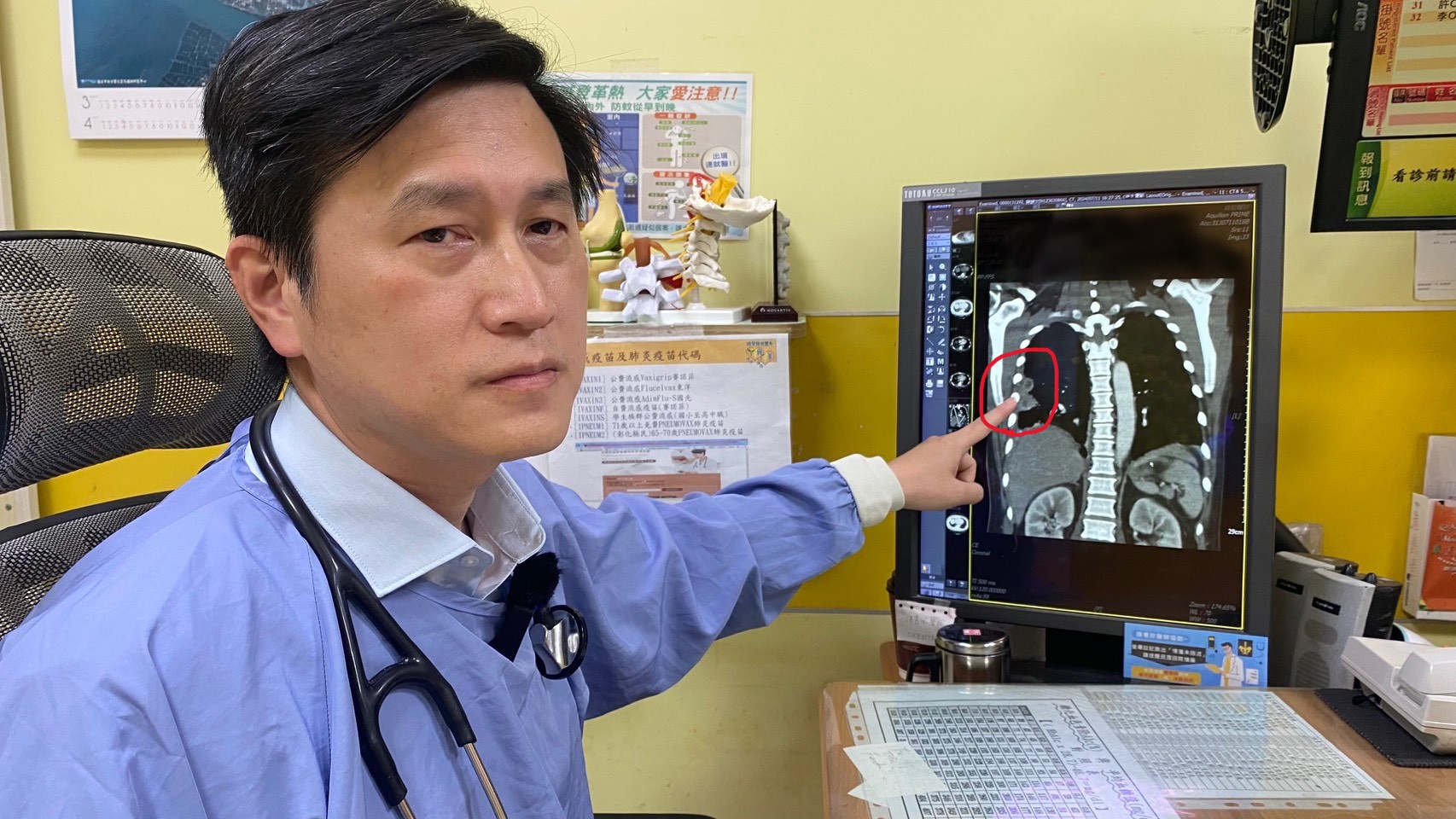 （有影片）／越南旅遊感染類鼻疽　男子截肢保命警示熱帶病風險