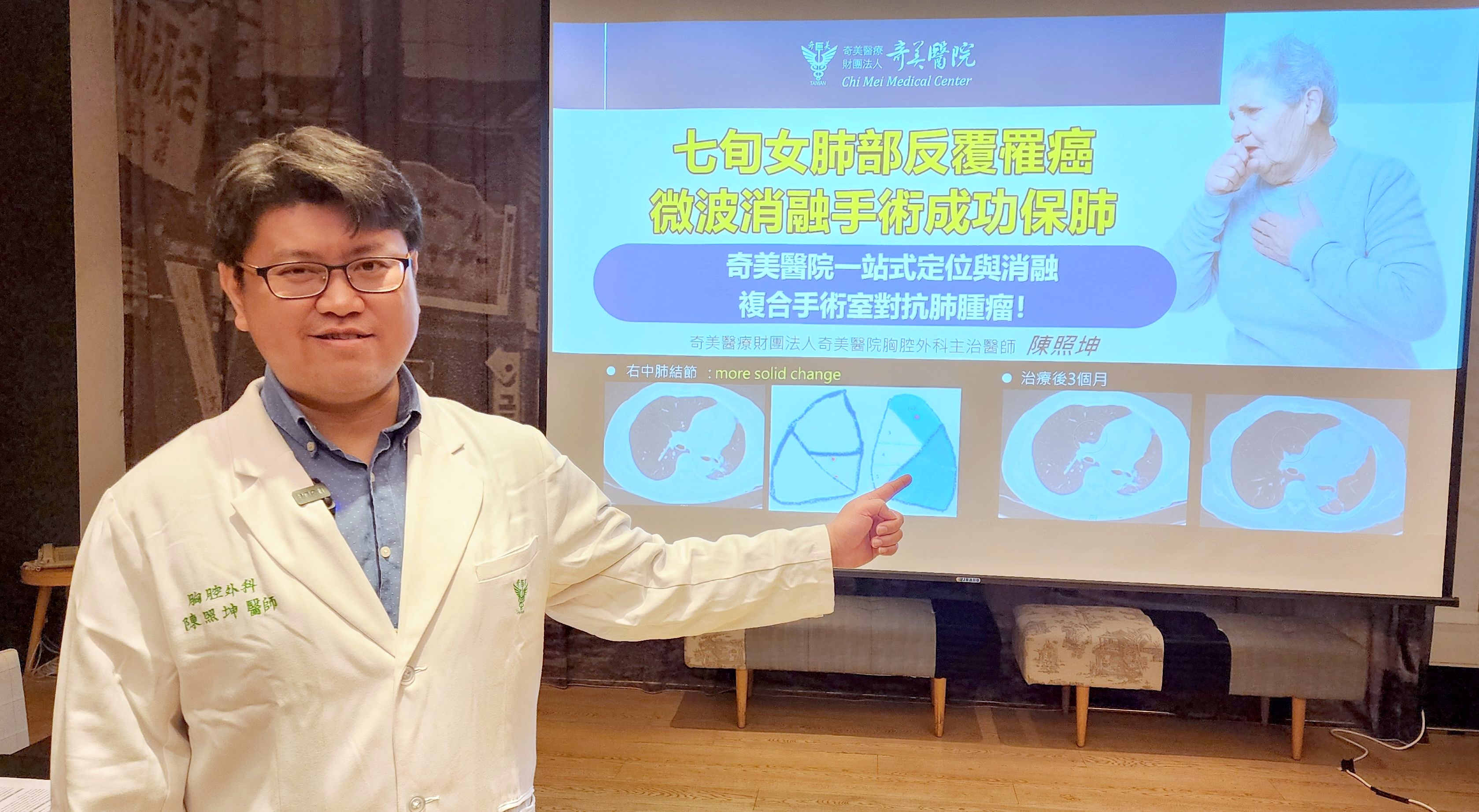 七旬女三度對抗肺腺癌，奇美醫院引進微波消融手術助攻成功保肺