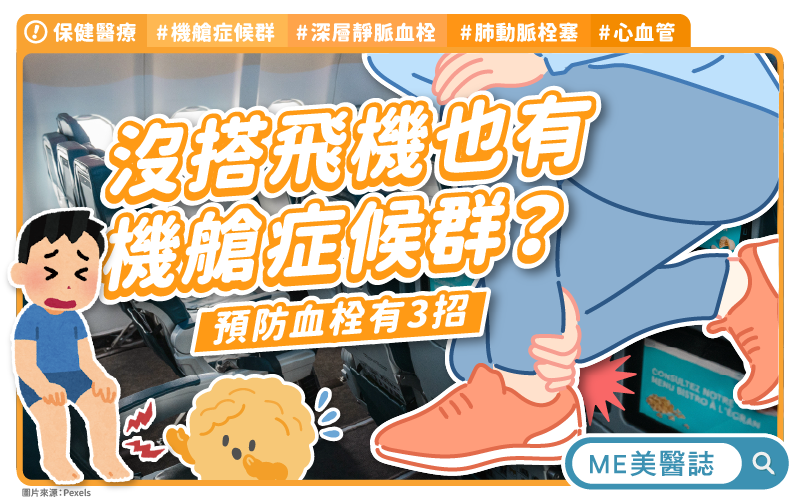 搭飛機、打麻將久坐不動引血栓？預防機艙症候群有3招–ME生活｜ME美醫誌
