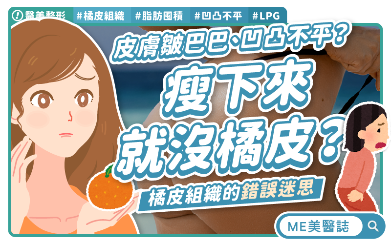橘皮成因不一定是肥胖?該怎麼消除橘皮?先了解橘皮組織! 橘皮成因不一定是肥胖?該怎麼消除橘皮?先了解橘皮組織!