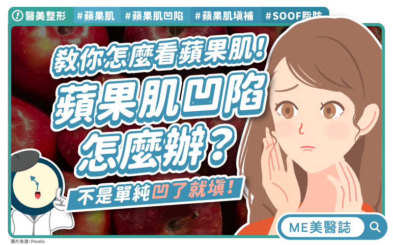 蘋果肌凹陷沒那麼簡單?填補蘋果肌要看年齡?別和眼袋搞混了! 蘋果肌凹陷沒那麼簡單?填補蘋果肌要看年齡?別和眼袋搞混了!