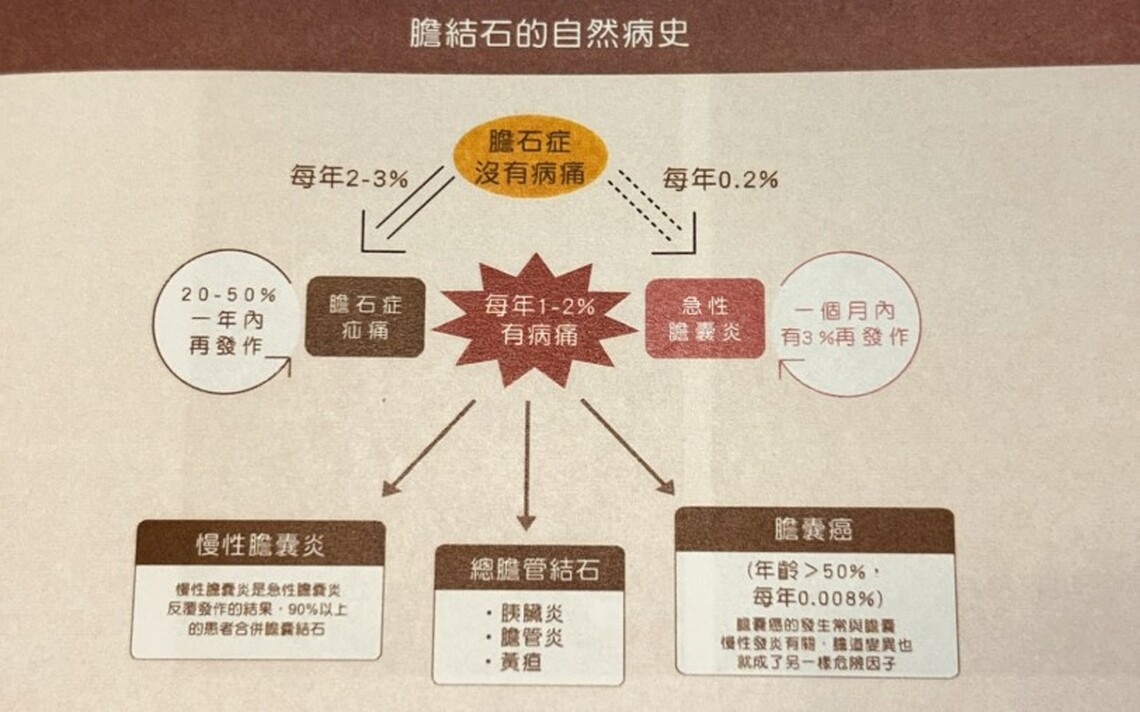 膽結石真會引發膽囊癌!全球罕見0.5%癌變機率發生在高雄男身上