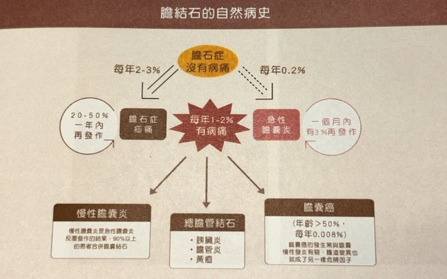 ▲博田國際醫院肝膽胰外科副院長李金德教授說明,膽結石的自然病程可分三階段,長期未處理可能引發為慢性膽囊炎,還可能引發膽管結石、胰臟炎、膽管炎或黃疸,甚至進一步癌化。