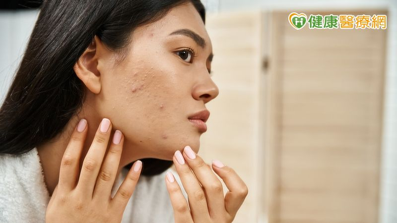 女性注意!痘痘體重狂飆、月經紊亂 小心不孕找上門