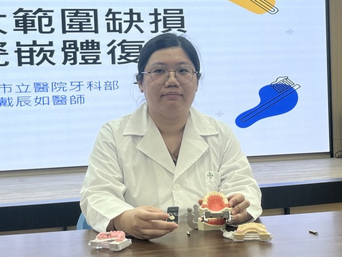 台南市醫大缺牙可用陶瓷嵌體美觀實用