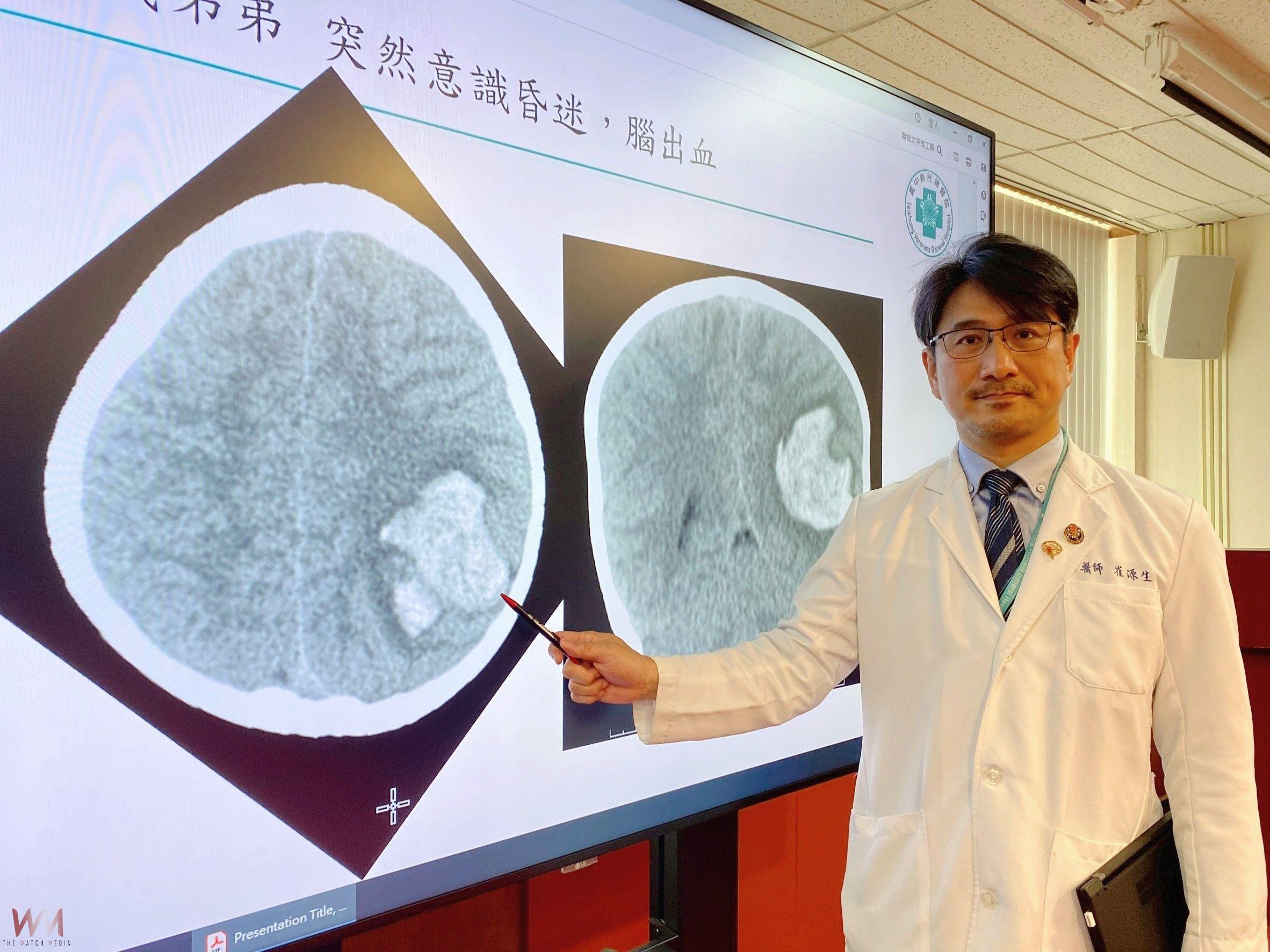 新式經靜脈血管造影術結合AR導航 臺中榮總精準腦內「拆彈」救童 - https://www.watchmedia01.com
