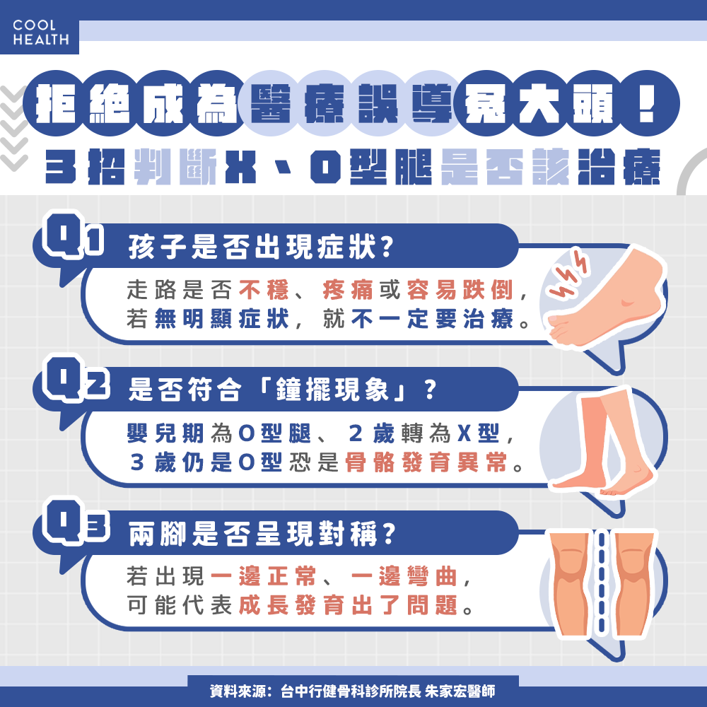 O型腿該不該矯正？  醫揭真相：並沒有「非治不可」，小心被誤導淪為冤大頭