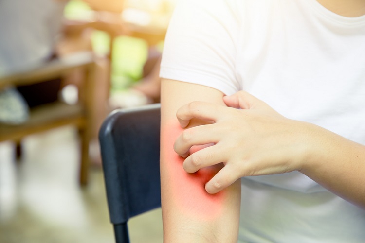 尿毒性搔癢症折磨慢性腎友，整合治療助恢復睡眠與生活品質