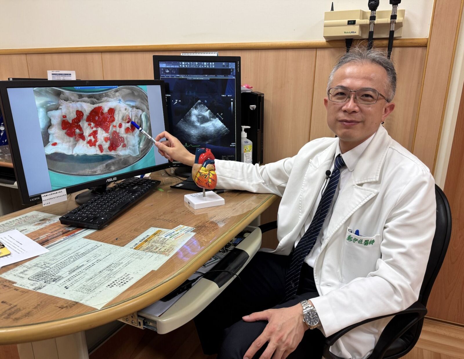 6旬婦半身癱軟 不是中風!而是心臟黏液瘤「隨心跳搖晃」 256 6旬婦半身癱軟 不是中風!而是心臟黏液瘤「隨心跳搖晃」 255