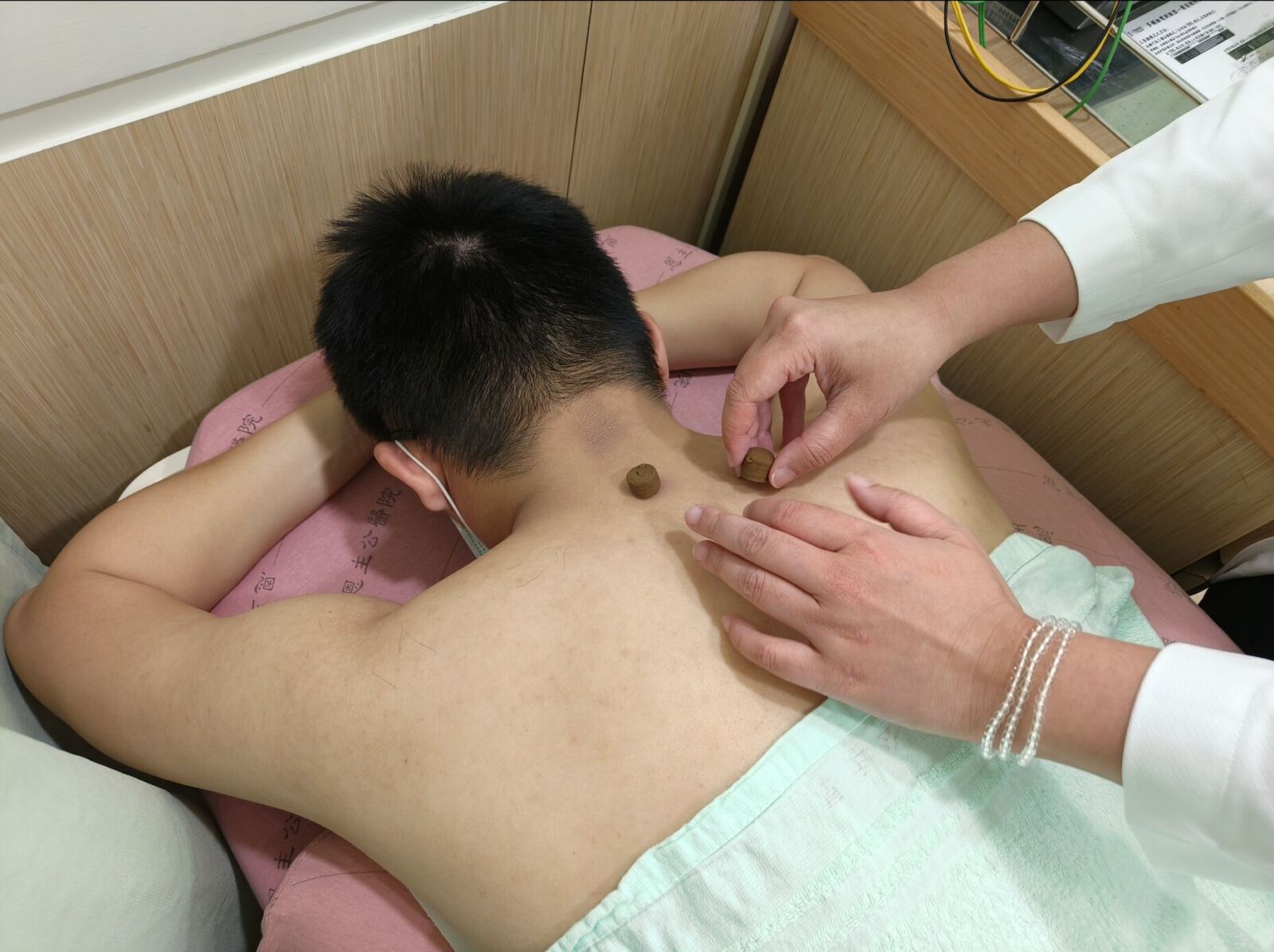 過敏兒瘋冬病夏治三伏貼 中醫：敷出「兩症狀」就不對勁！ 277