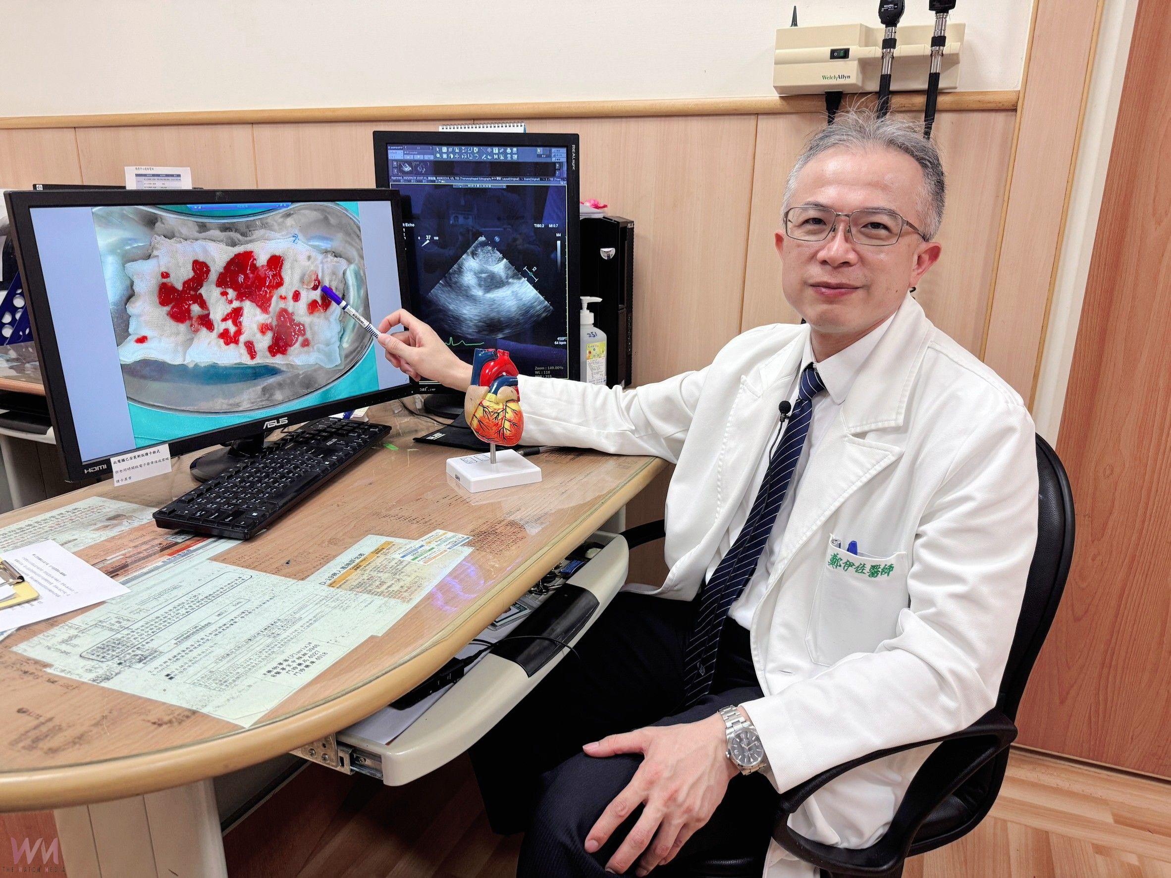 中風竟是心臟黏液瘤作怪 台中慈醫:6旬婦微創開心手術成功救命 - https://www.watchmedia01.com