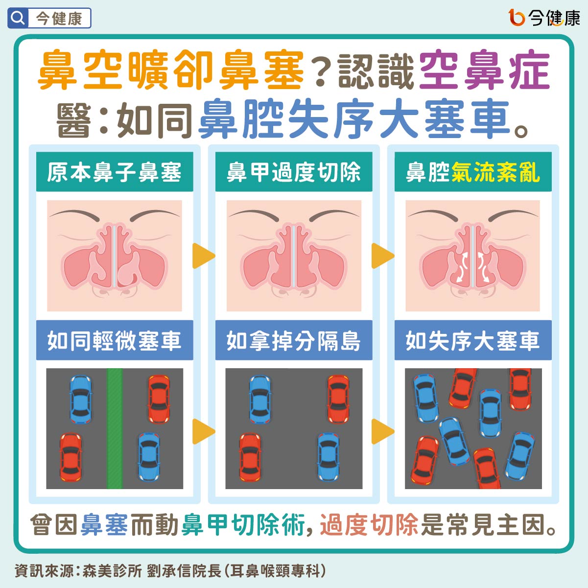 #劉承信 #空鼻症 #鼻塞 #乾燥 #憂鬱 #失眠