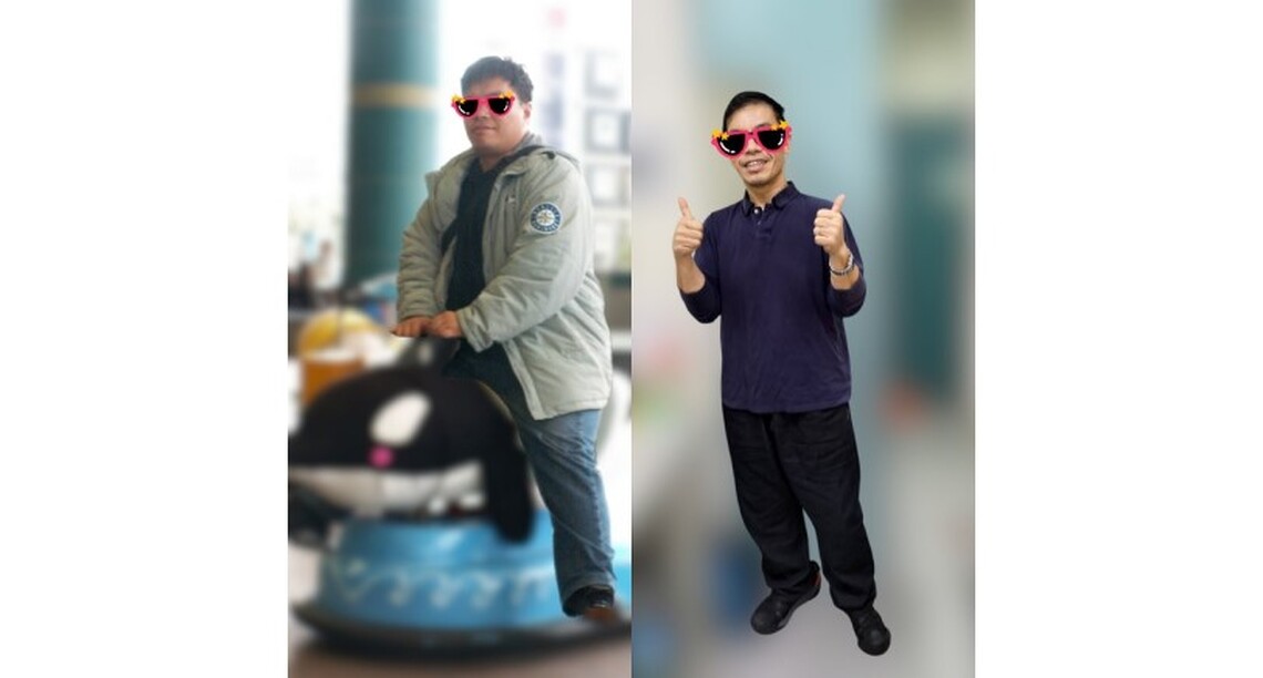 夫妻同心攜手甩肉50公斤!小港醫院透過「內視鏡袖狀胃成形術」助夫妻檔找回健康與自信
