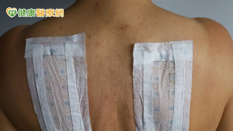 一變天就鼻塞?中醫師:三伏貼改善鼻炎有幫助 但這些人要慎用