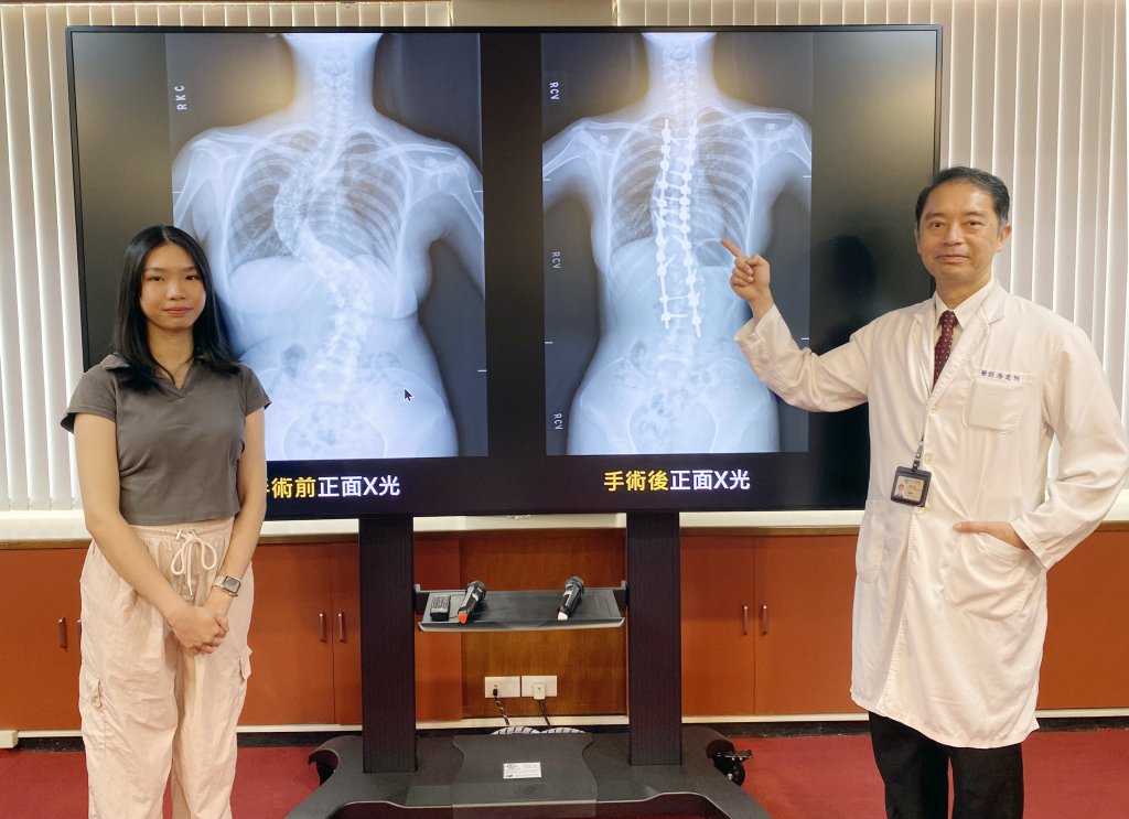 「脊椎蜈蚣」纏身18年-中榮脊椎機械手臂神救援