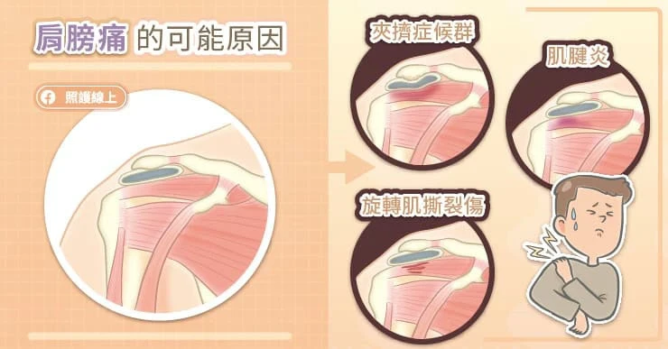肩膀痛的可能原因
