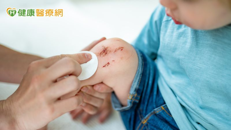 小擦傷想自己消毒殺菌 優碘、碘酒卻分不清? 用錯可能延緩傷口復原!