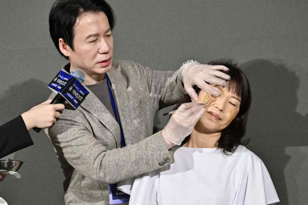 「一次撕斑」重拾嬰兒肌!AI精準雷射療程 打破傳統除斑限制 246 「一次撕斑」重拾嬰兒肌!AI精準雷射療程 打破傳統除斑限制 245