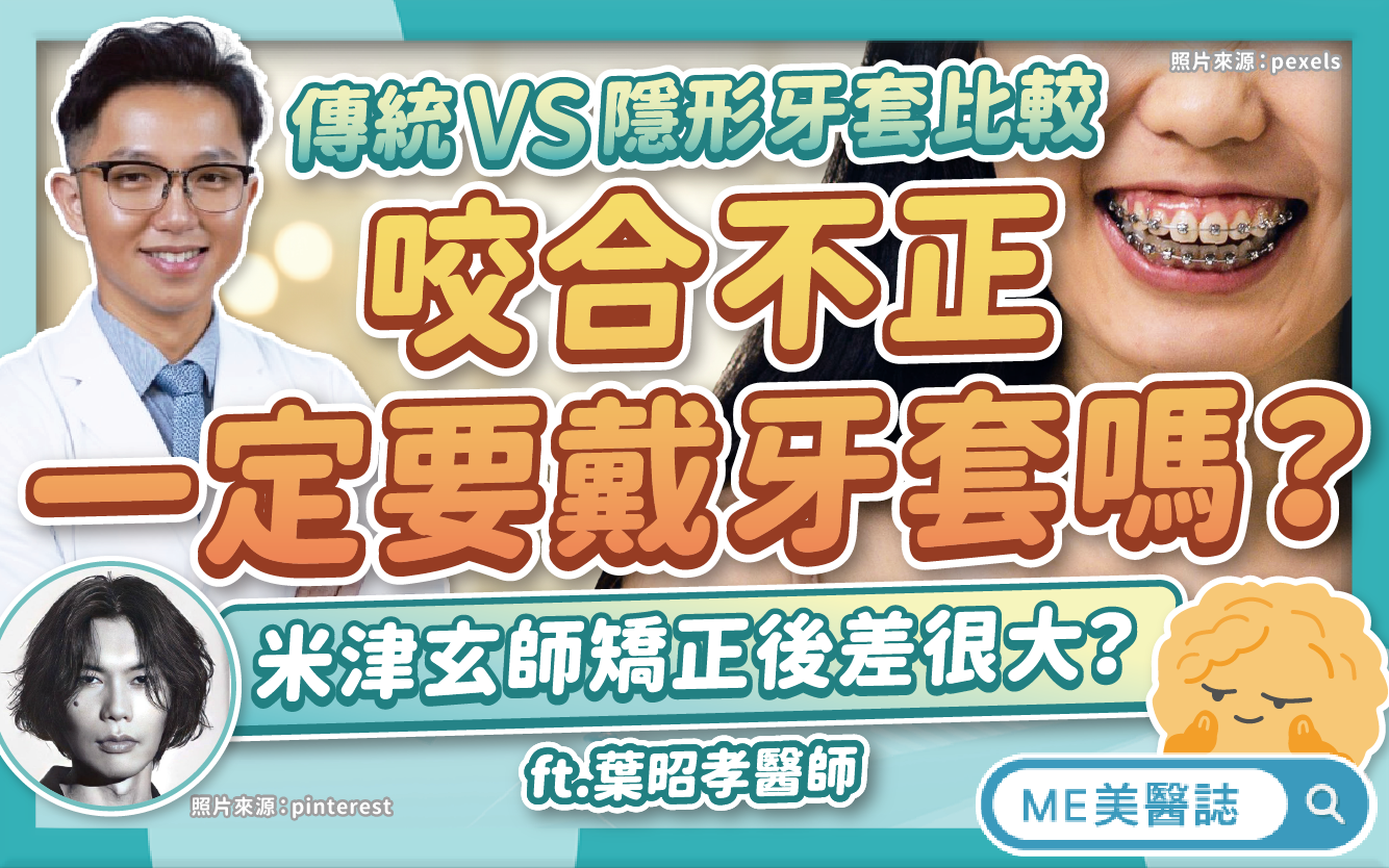 咬合不正一定要戴牙套?分析米津玄師矯正前後差異!維持器要戴多久?–名醫問診室|ME美醫誌