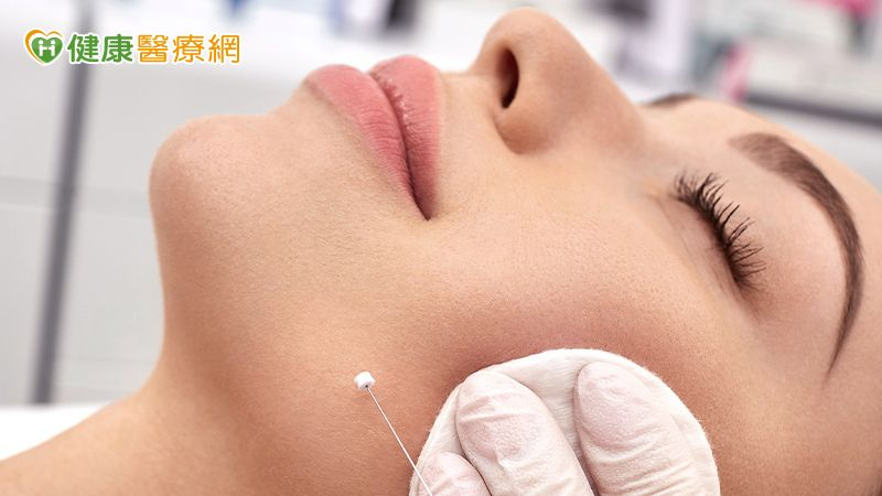 埋線拉提能逆齡?醫師揭線雕抗老真相