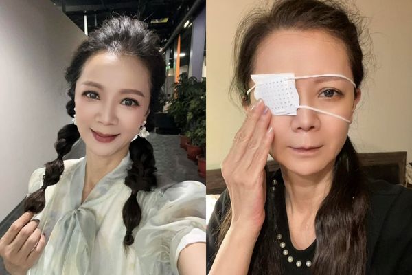 ▲▼高欣欣「眼睛藥水點錯」險失明 提醒1關鍵:以免發生慘案。(圖/翻攝自Facebook/高欣欣 欣想事成俱樂部)
