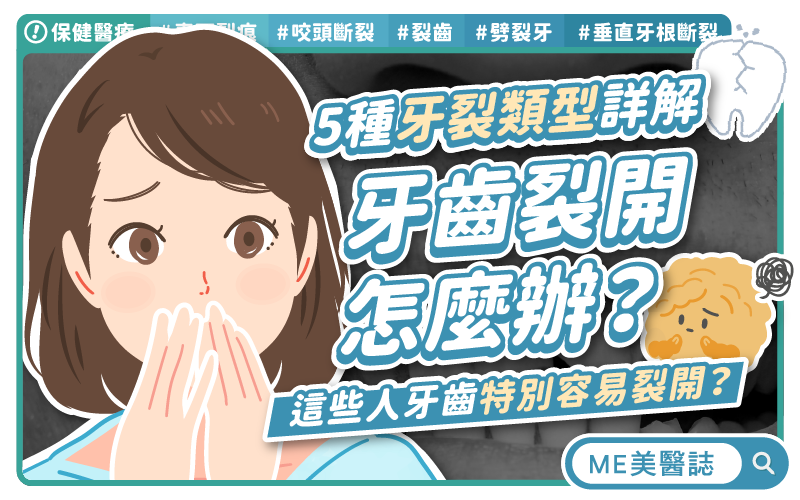 牙齒咬一下就痛?別急著植牙!牙醫教你分辨5種牙裂處理方式 牙齒咬一下就痛?別急著植牙!牙醫教你分辨5種牙裂處理方式