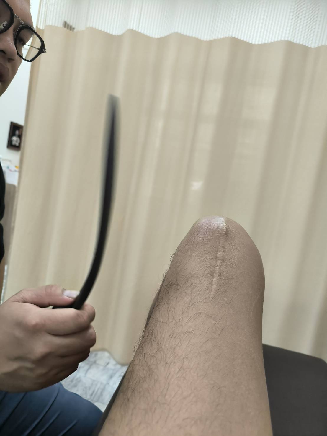 骨骼沾黏：術後復原的最大關卡！破解的關鍵，是「破壞再重建」