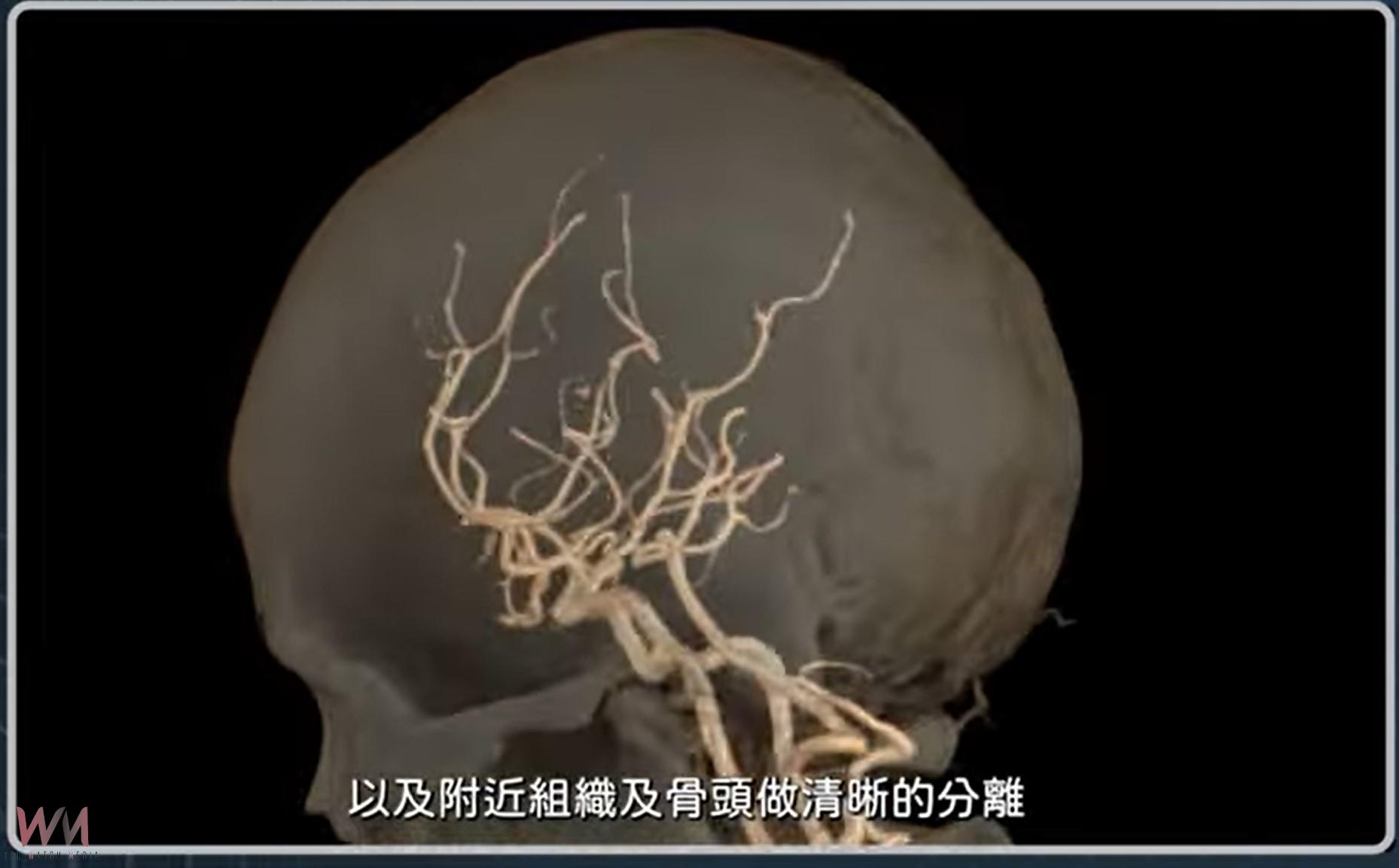 (有影片)/成大醫院256切高階CT落戶雲林 癌症心血管等檢查更快速精準 - https://www.watchmedia01.com