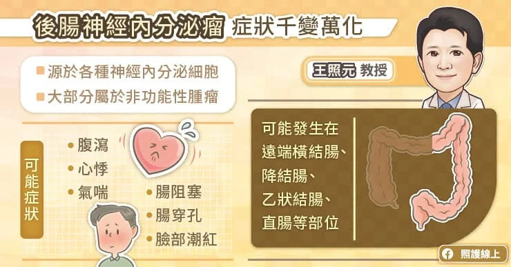 後腸神經內分泌瘤症狀