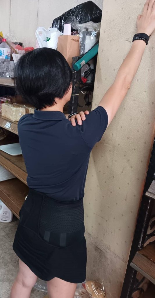 54歲婦女右肩酸痛誤為五十肩-員榮陳宏銘醫師查出脂肪瘤作祟