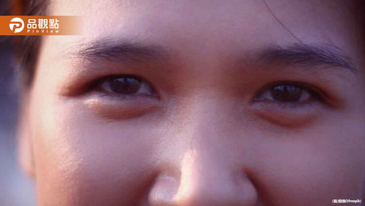 黑眼圈眼袋有救了!營養師揭密消除秘方 8招讓你重拾明亮雙眼