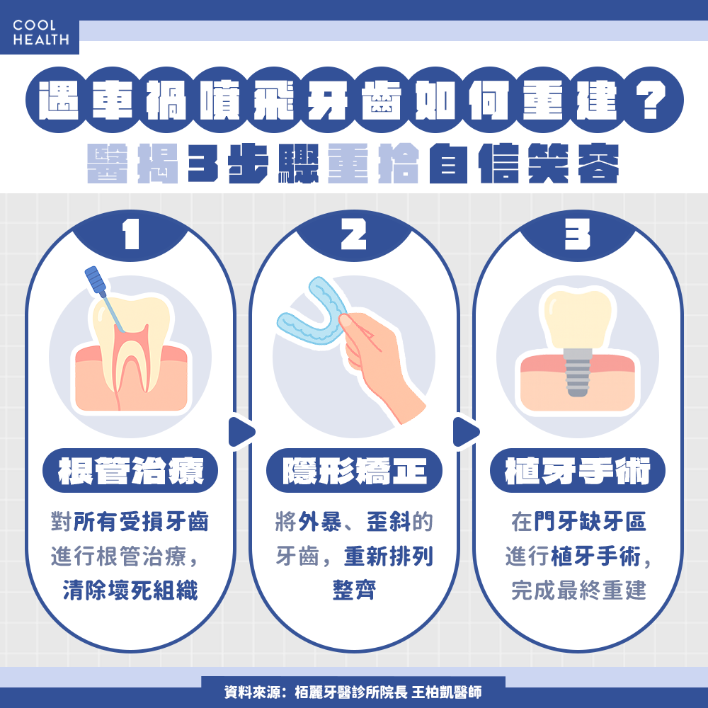 遇車禍噴飛兩顆門牙! 她用「隱形矯正+植牙手術」重拾笑容
