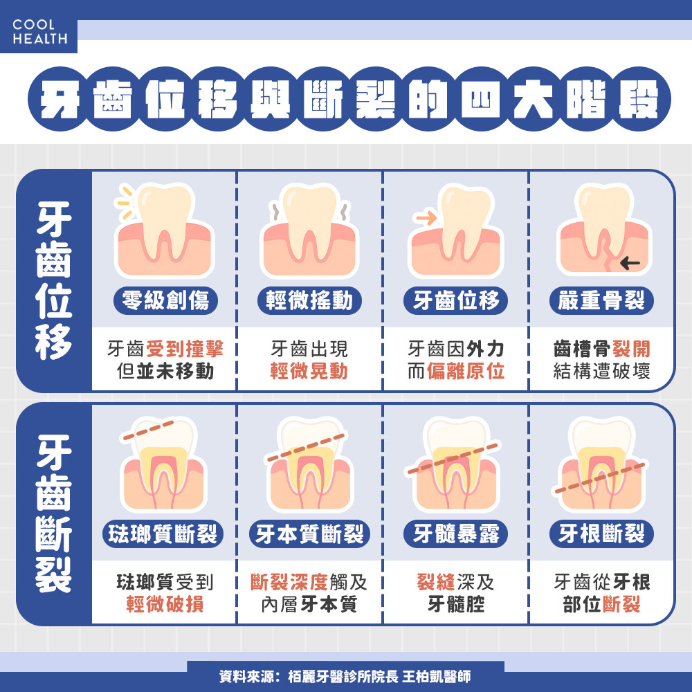 車禍撞斷牙齒還能黏回去嗎？ 醫揭真相：實務上效果差，裂在「這位置」還得抽神經