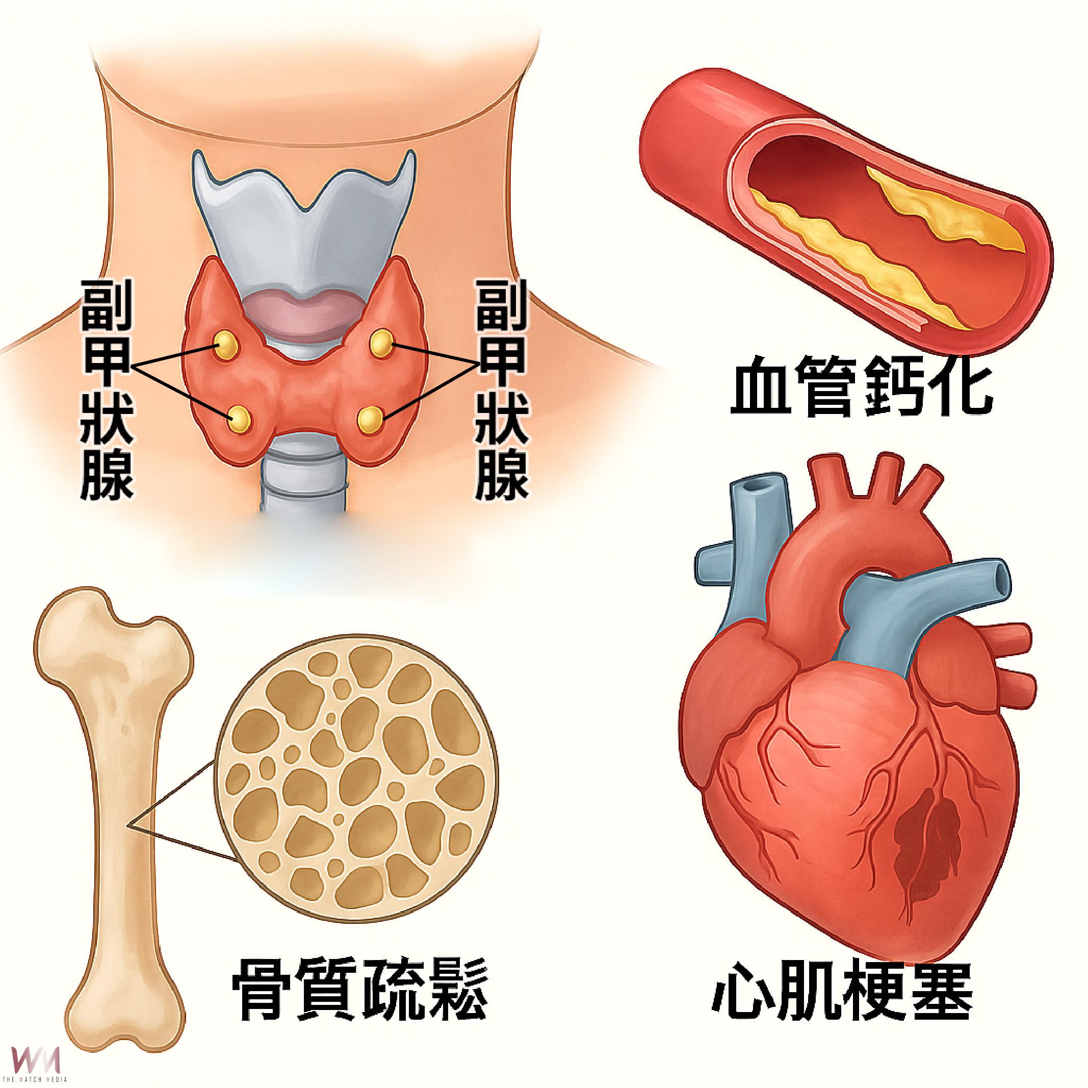 (有影片)/彰化醫院手術治癒副甲狀腺亢進 洗腎病患擺脫骨痛搔癢 - https://www.watchmedia01.com