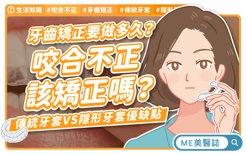 咬合不正要治療嗎?隱形牙套優缺點?牙齒矯正後的注意事項 咬合不正要治療嗎?隱形牙套優缺點?牙齒矯正後的注意事項
