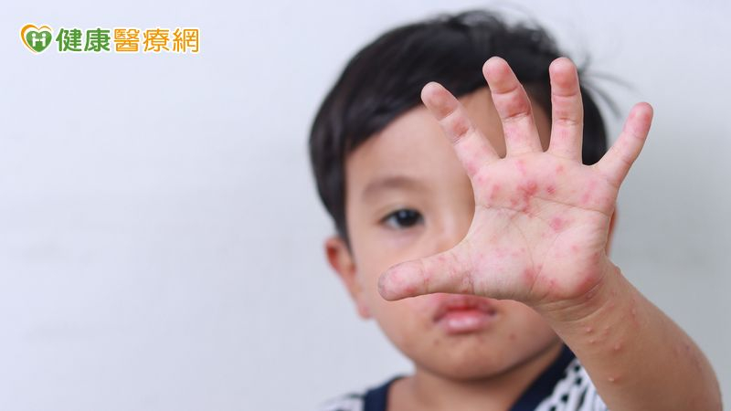 腸病毒重症已奪8命!伊科11型來勢洶洶 疾管署:幼童是高風險族群