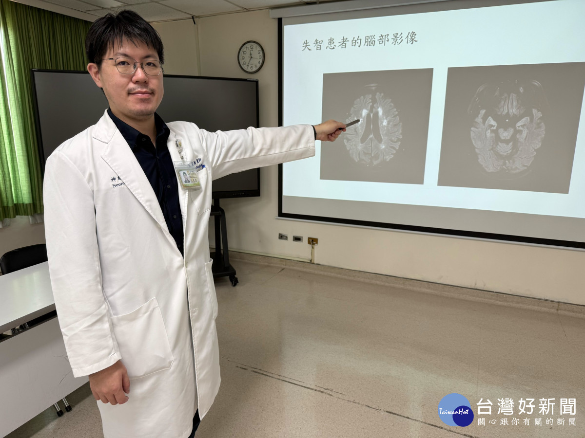 王興翰醫師以腦部斷層掃描影片,說明失智患者腦部記憶區萎縮的狀況。