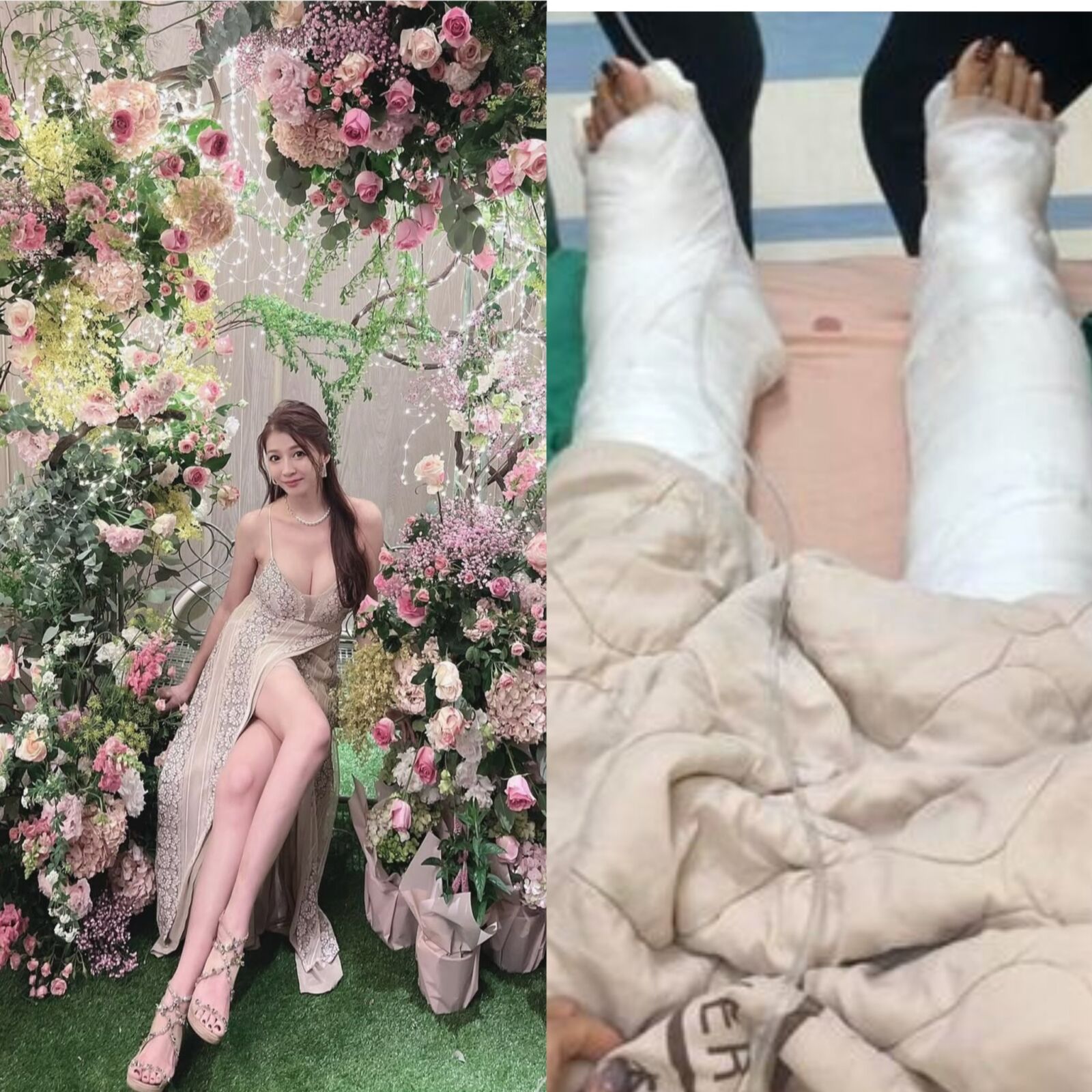 「最美禮生」搭艇出海翻船美腿遭捲螺旋槳 船長挨告最終結果出爐 244 「最美禮生」搭艇出海翻船美腿遭捲螺旋槳 船長挨告最終結果出爐 243