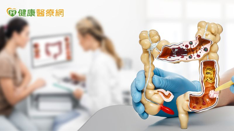 陪夫健檢6旬婦意外發現大腸癌 自然孔微創手術成功切除