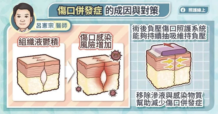 傷口併發症的成因與對策