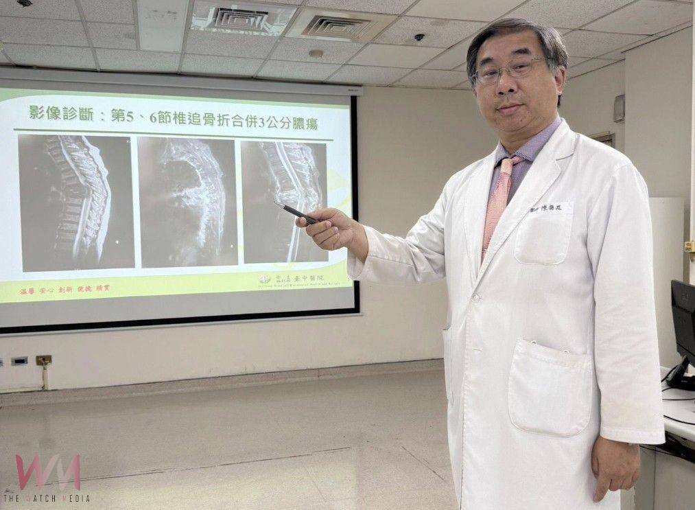 婦女背痛3個月未癒還痛到掛急診 原來有顆大膿包壓迫脊髓神經 - https://www.watchmedia01.com