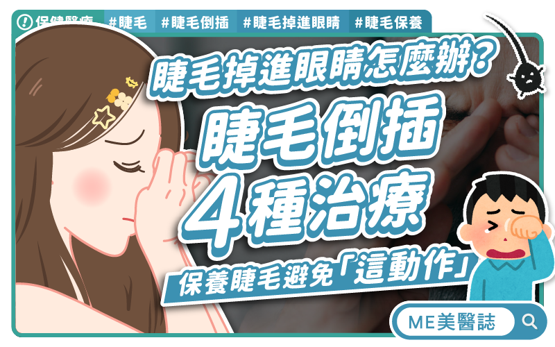 睫毛掉進眼睛怎麼辦?睫毛倒插怎治療?日常4招保養睫毛 睫毛掉進眼睛怎麼辦?睫毛倒插怎治療?日常4招保養睫毛