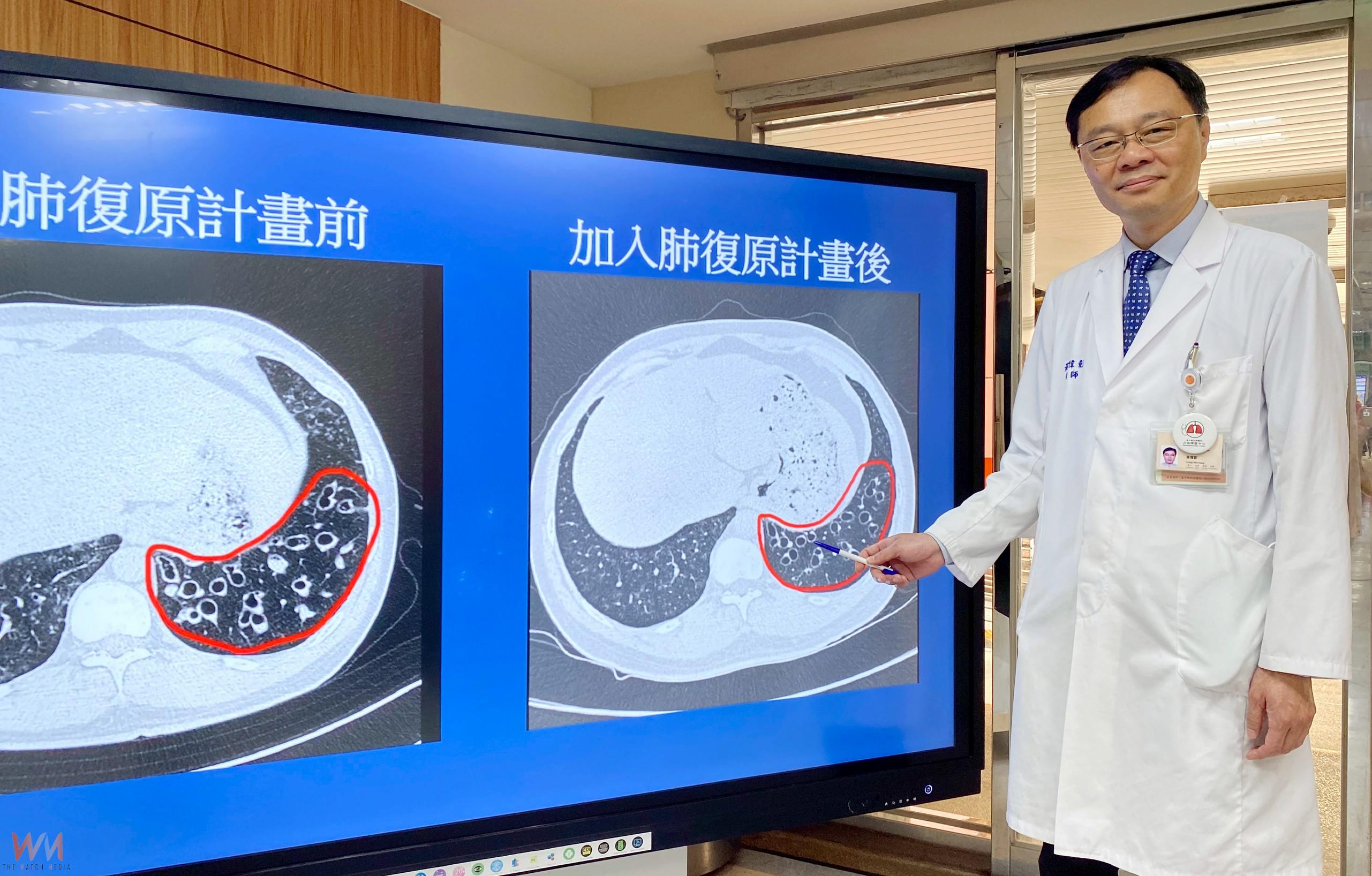 臺中榮總成立「呼吸道疾病整合照護中心」 助病人順暢每一口呼吸 - https://www.watchmedia01.com